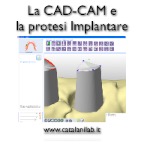 Protesi Implantare